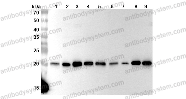 Anti-Human PSMB5 Polyclonal Antibody