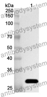 Anti-GSTM2 Polyclonal Antibody