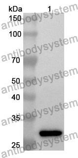 Anti-ABCD3 Polyclonal Antibody