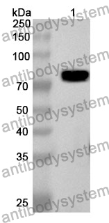 Anti-Human CHAT Polyclonal Antibody