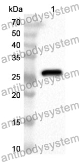 Anti-ACADL Polyclonal Antibody