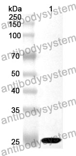 Anti-NDUFS1 Polyclonal Antibody