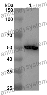 Anti-POLD1 Polyclonal Antibody