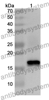 Anti-GCA Polyclonal Antibody