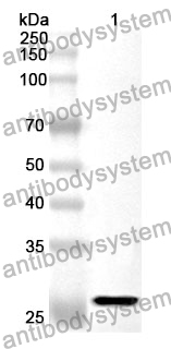 Anti-ERCC5 Polyclonal Antibody