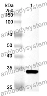 Anti-CD1b Polyclonal Antibody