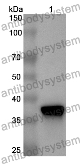 Anti-Human S100A2 Polyclonal Antibody