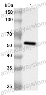 Anti-Human TPP2 Polyclonal Antibody