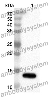 Anti-CTGF/CCN2 Polyclonal Antibody