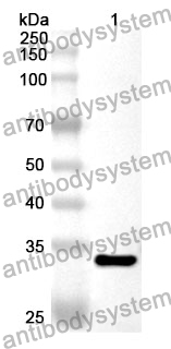 Anti-PTPN6 Polyclonal Antibody