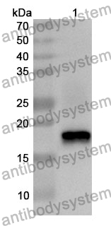 Anti-CRABP2 Polyclonal Antibody