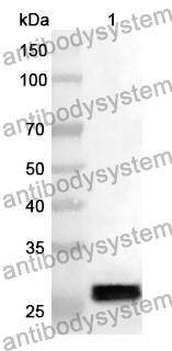 Anti-SERPINB3 Polyclonal Antibody