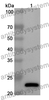 Anti-Human LMOD1 Polyclonal Antibody