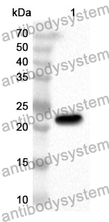 Anti-Human EEF1D Polyclonal Antibody