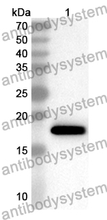 Anti-CRABP1 Polyclonal Antibody