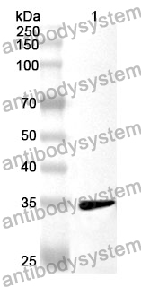 Anti-AQP1 Polyclonal Antibody