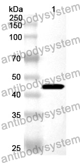 Anti-GNA11 Polyclonal Antibody