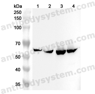 Anti-Human ALDH4A1 Polyclonal Antibody