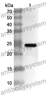 Anti-BLVRB Polyclonal Antibody