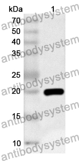 Anti-ATP5F1D Polyclonal Antibody