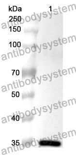 Anti-CCND2 Polyclonal Antibody