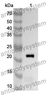 Anti-Human CDC25A Polyclonal Antibody