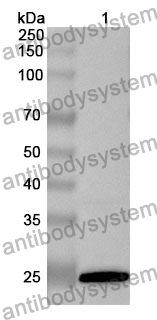 Anti-CDC25B Polyclonal Antibody