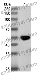 Anti-Human ADSS2 Polyclonal Antibody