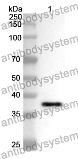 Anti-AXL/UFO Polyclonal Antibody