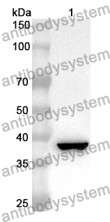 Anti-GRPR Polyclonal Antibody