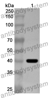 Anti-ADSL Polyclonal Antibody