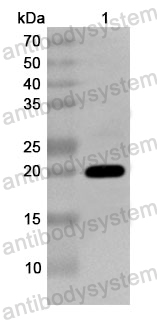 Anti-Human SRI Polyclonal Antibody