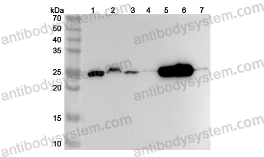 Anti-Human GSTT1 Polyclonal Antibody