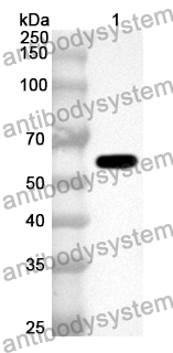 Anti-ALDH1B1 Polyclonal Antibody