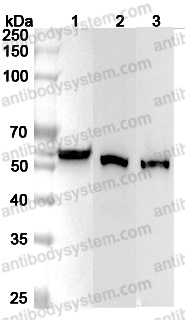 Anti-Human ALDH3A1 Polyclonal Antibody