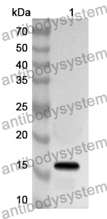 Anti-NTS Polyclonal Antibody