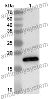 Anti-Human LCN1 Polyclonal Antibody