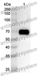 Anti-Human SDHA Polyclonal Antibody