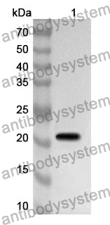 Anti-CORO1A Polyclonal Antibody