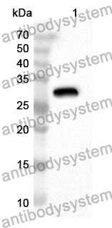 Anti-GDI1 Polyclonal Antibody