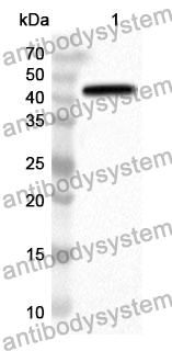 Anti-SRD5A2 Polyclonal Antibody