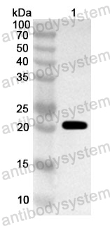 Anti-Human HOXA10 Polyclonal Antibody