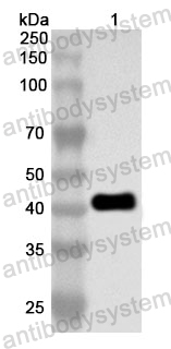 Anti-Human CASQ1 Polyclonal Antibody