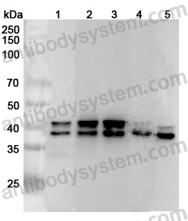 Anti-Human TIA1 Polyclonal Antibody