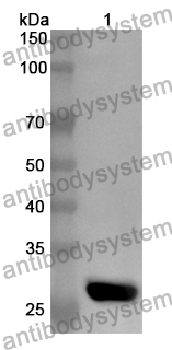 Anti-Human DNAJA1 Polyclonal Antibody