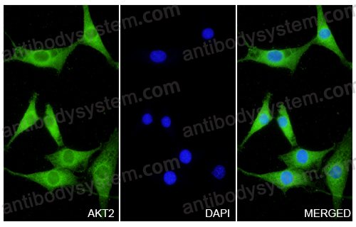 Anti-AKT2 Polyclonal Antibody