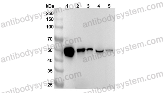 Anti-Human HNRNPH1 Polyclonal Antibody