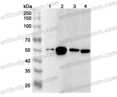 Anti-Human HNRNPH1 Polyclonal Antibody