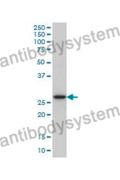 Anti-CASP14 Polyclonal Antibody