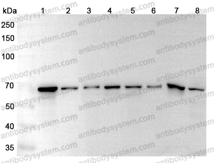 Anti-STIP1 Polyclonal Antibody